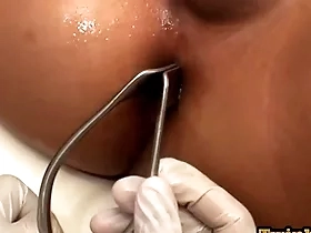 Asian patient penetrated respecting anal cleft by stud respecting missionary