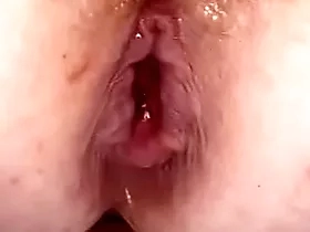 Anal bomb nearly my arse